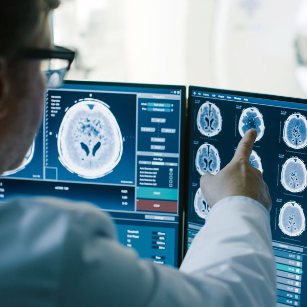 Brain scan